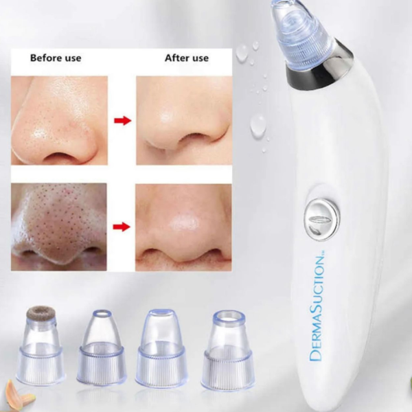 DermaSuction Pore Cleaning Device (Pack of 1)